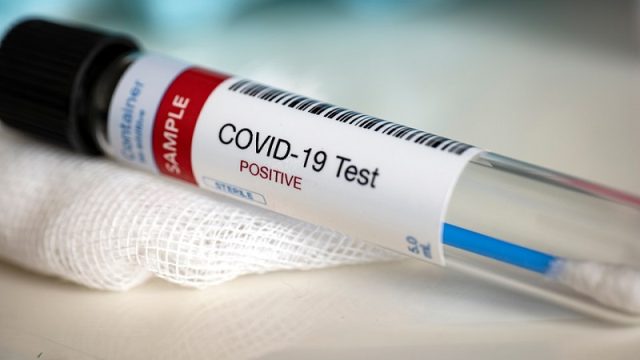 Test_Tube_COVID-19_Sample_960x640.jpg