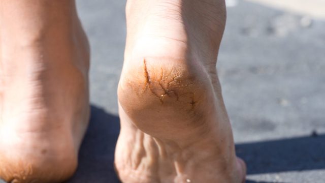 iStock-530194498-1024x683.jpg